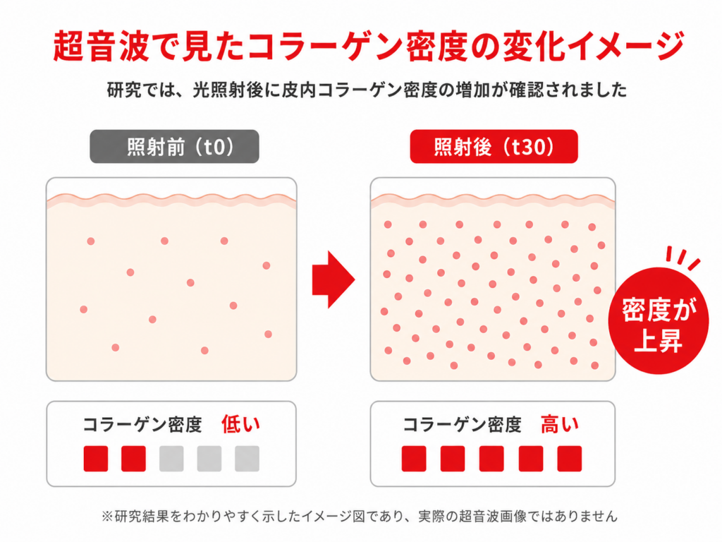 超音波で見たコラーゲン密度の変化